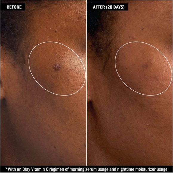 Olay Vitamin C Skincare Set - Orange - Picture 9 of 12